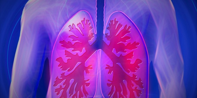 Allergisches Asthma - Asthma bronchiale