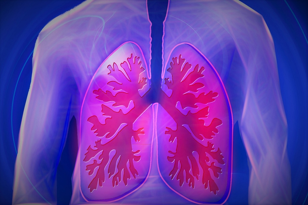 Allergisches Asthma - Asthma bronchiale
